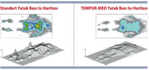 Yatak Yarası Bası Yaraları Dekübitus ve Dekübit Ülseri